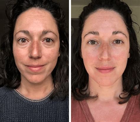 jade roller benefits before and after|Jade Roller Benefits: We Investigated What Jade .